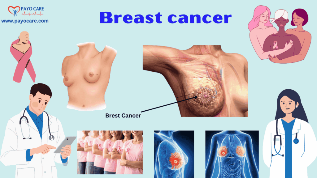 Breast Cancer: Types, Causes, Symptoms, Prevention & Treatment