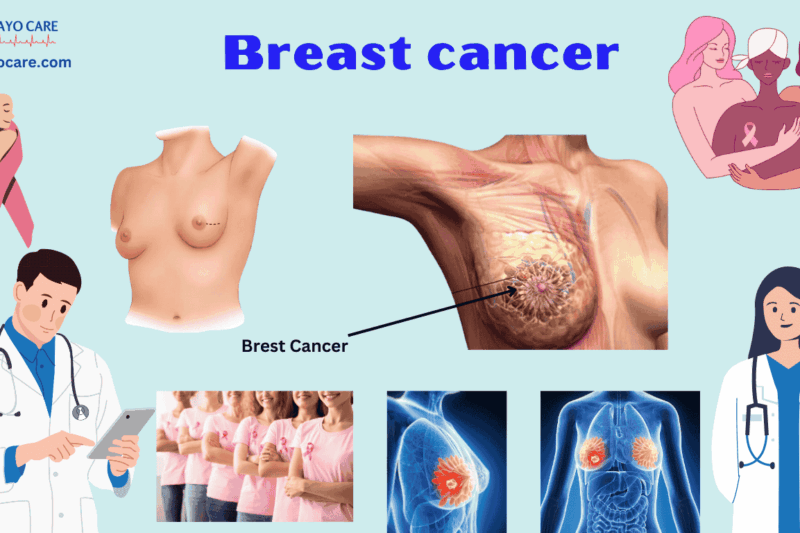 Breast Cancer: Causes, Symptoms & Treatment