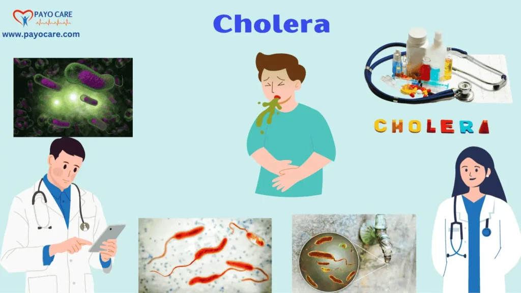 Cholera: Types, Causes, Symptoms, Prevention, Diagnosis, and Treatments – The Ultimate Guide Cholera: Types, Causes, Symptoms, Prevention, Diagnosis, and Treatments – The Ultimate Guide
