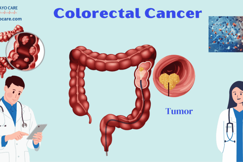 Colorectal Cancer: Causes, Symptoms & Treatments