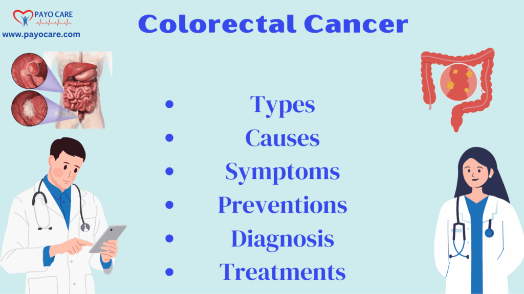 Colorectal Cancer: Types, Causes, Symptoms, Prevention, Diagnosis, and Treatments