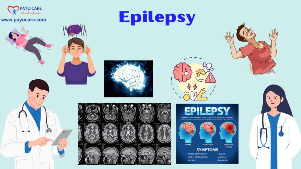 Epilepsy: Types, Causes, Symptoms, Preventions, Diagnosis & Treatments