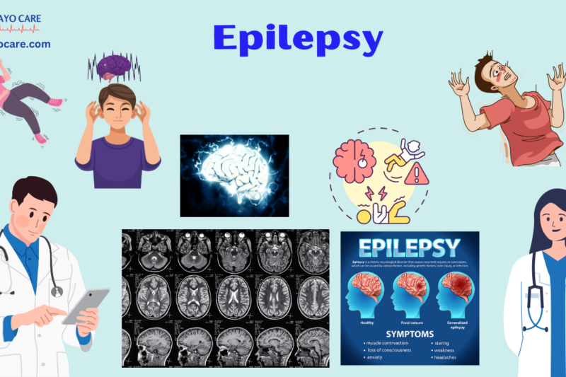 Epilepsy:Causes, Symptoms & Treatments