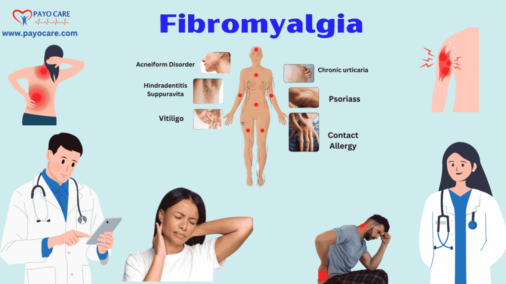 Fibromyalgia :Types, Causes, Symptoms, Prevention, Diagnosis & Treatment Fibromyalgia :Types, Causes, Symptoms, Prevention, Diagnosis & Treatment