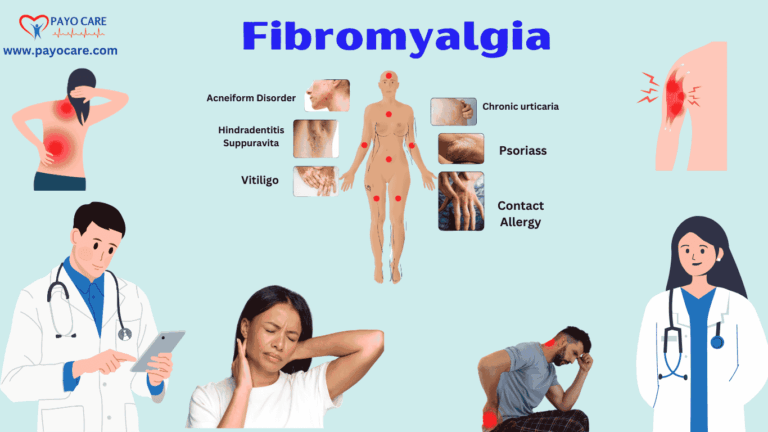 Fibromyalgia :Types, Causes, Symptoms, Prevention, Diagnosis & Treatment