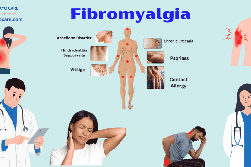 Fibromyalgia :Causes, Symptoms, Prevention & Treatment