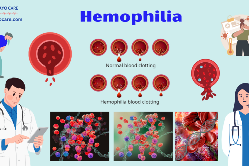 Hemophilia: Causes, Symptoms, Prevention & Treatment