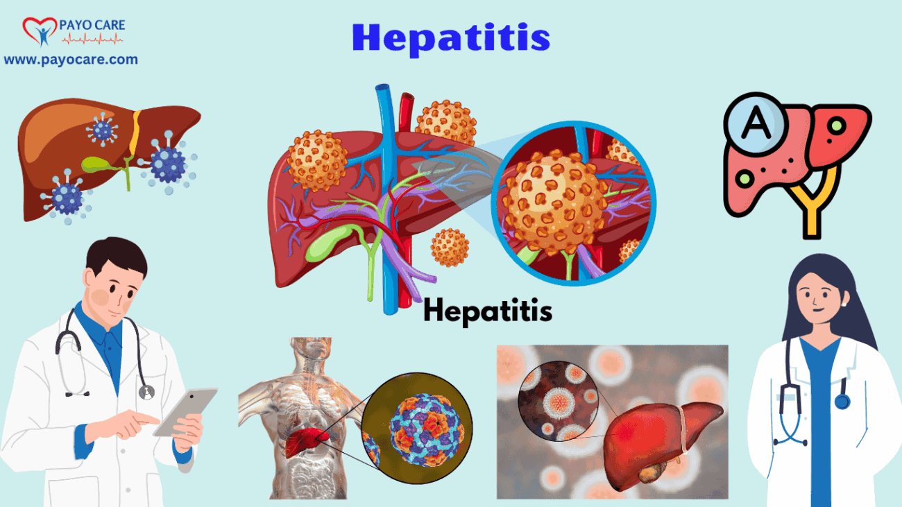 Hepatitis: Types, Causes, Symptoms, Prevention, Diagnosis & Treatment