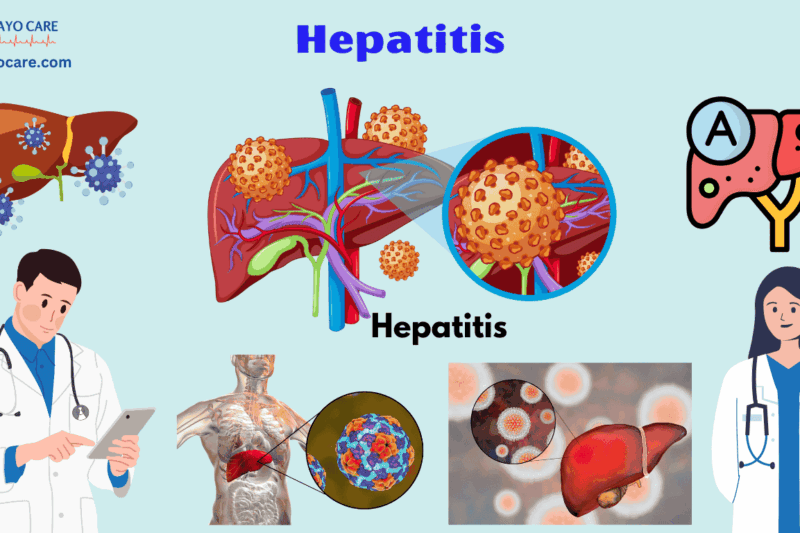 Hepatitis :Causes, Symptoms,Prevention & Treatment