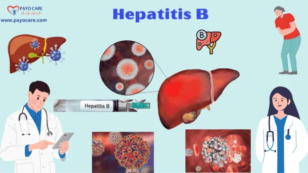 Hepatitis B: Types, Causes, Symptoms, Treatment, Prevention, and Diagnosis
