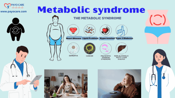 Metabolic syndrome :Types, Causes, Symptoms, Prevention, Diagnosis & Treatment