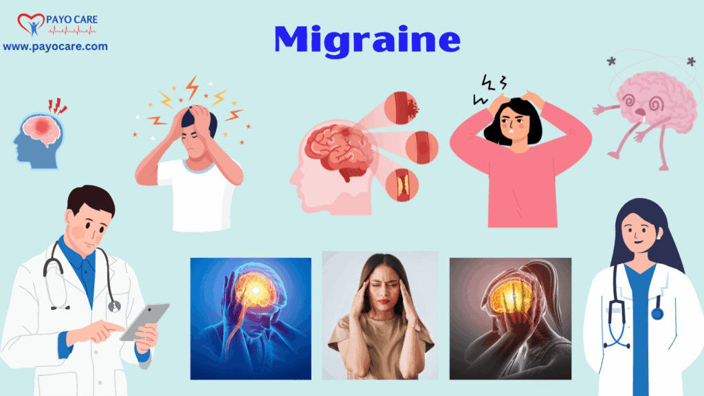 Migraines: Types, Causes, Symptoms, Prevention, Diagnosis & Treatment