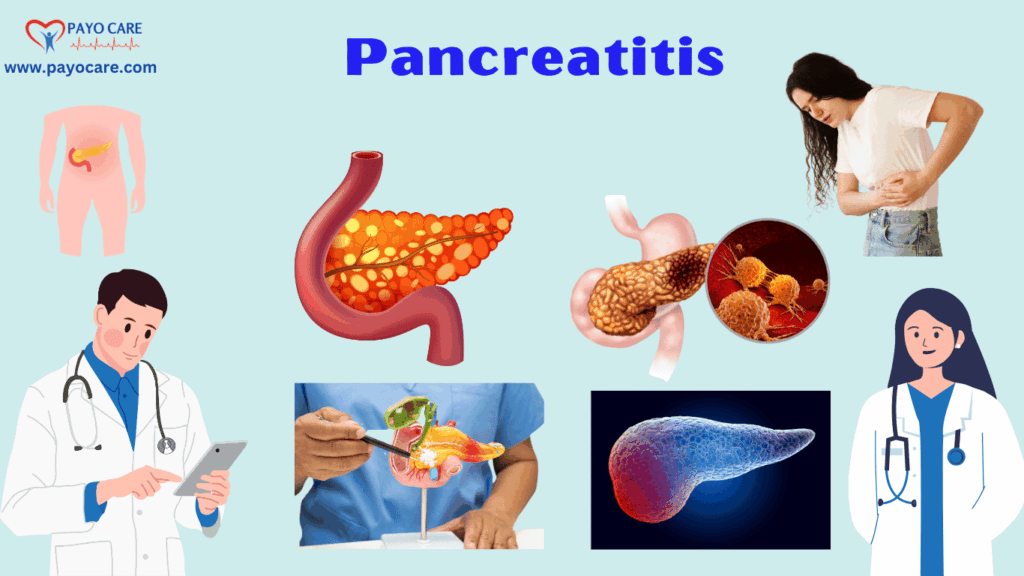 Pancreatitis:Types, Causes, Symptoms, Prevention, Diagnosis & Treatment Pancreatitis:Types, Causes, Symptoms, Prevention, Diagnosis & Treatment