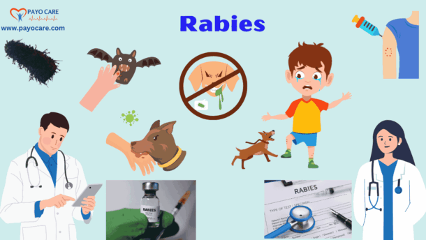 Rabies :Types, Causes, Symptoms, Prevention, Diagnosis & Treatment