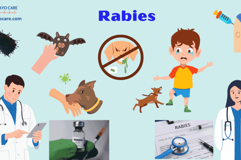 Rabies :Causes, Symptoms & Treatment
