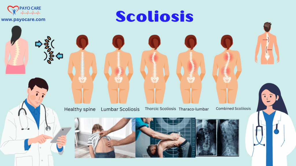 Scoliosis: Types, Causes, Symptoms, Prevention, Diagnosis & Treatment