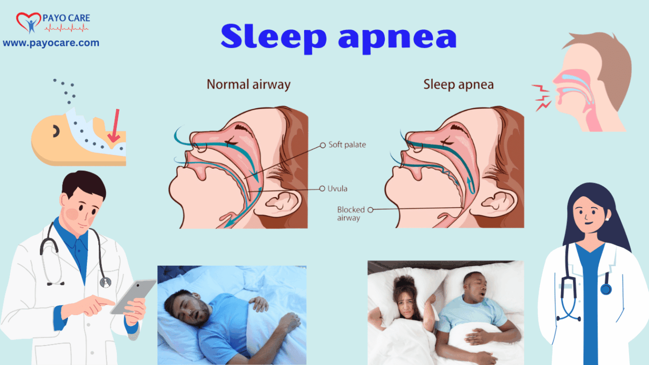 Sleep Apnea: Types, Causes, Symptoms, Prevention, Diagnosis & Treatment