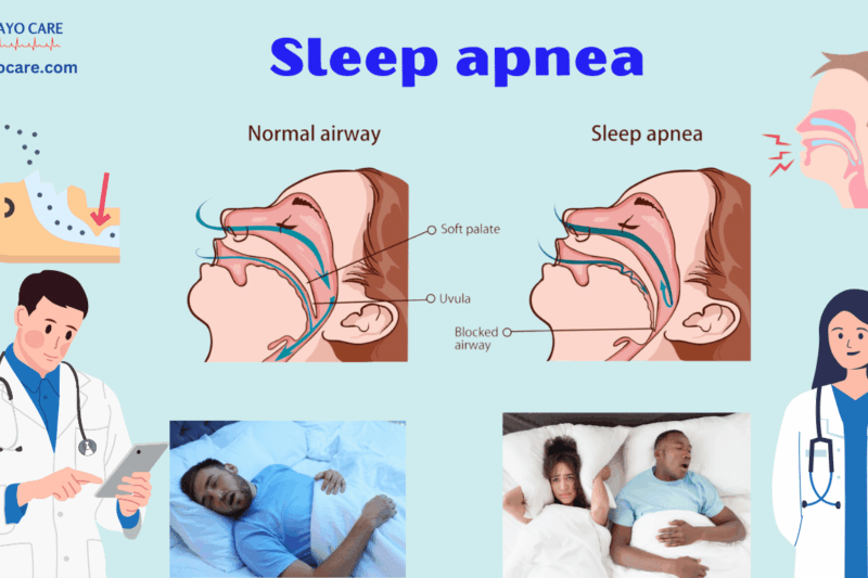 Sleep Apnea: Types, Causes, Symptoms & Treatment