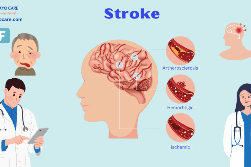 Stroke: Causes, Symptoms & Prevention