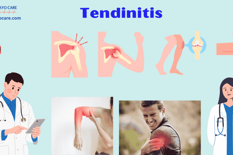 Tendinitis: Causes, Symptoms, Prevention & Treatment