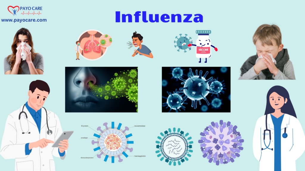 Influenza: Types, Causes, Symptoms,Diagnosis & Treatments
