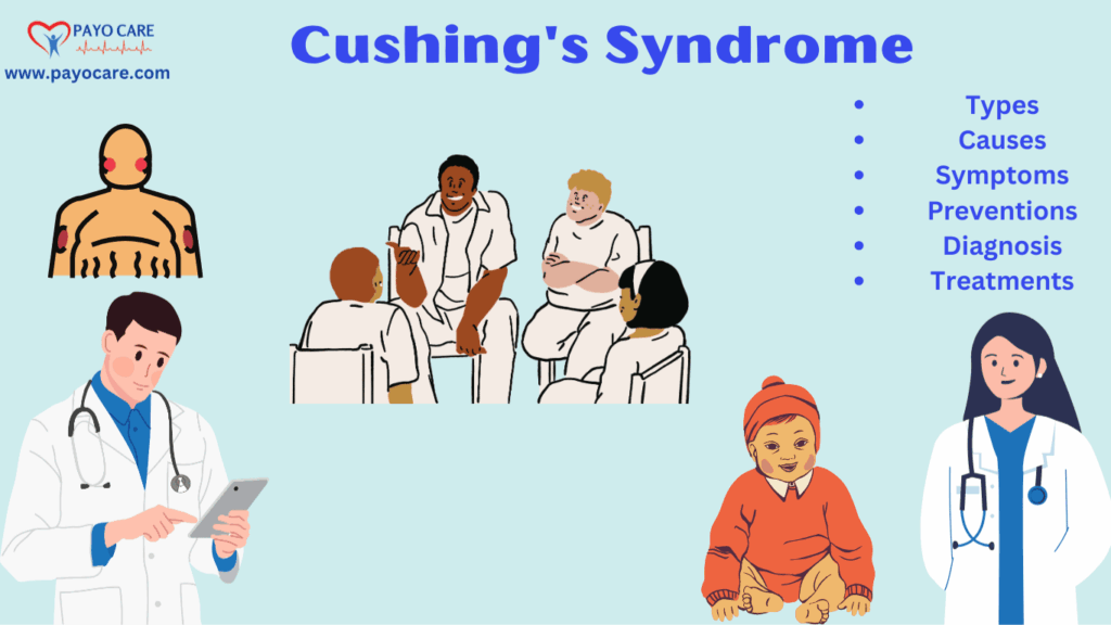 cushing syndrome: A Complete Guide to Symptoms, Treatment, and Prevention