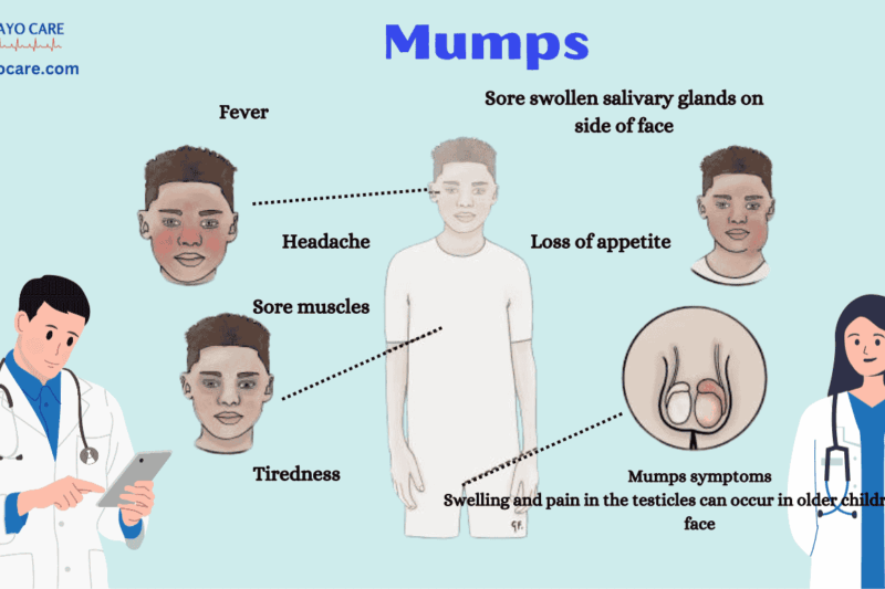 Mumps: Causes, Symptoms and Treatment