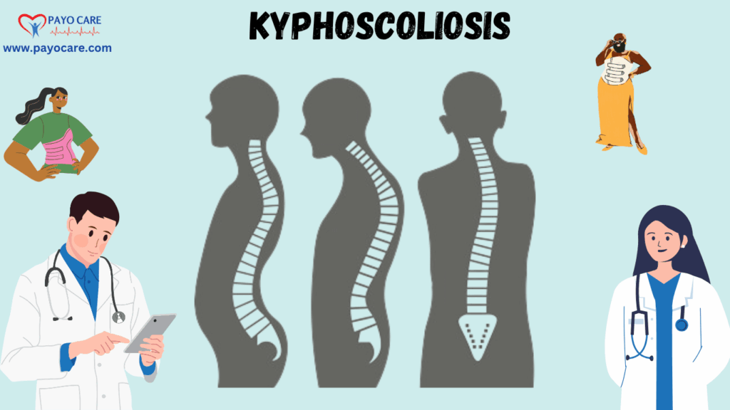 Kyphoscoliosis: Causes, Symptoms, Prevention, Diagnosis, and Treatment Kyphoscoliosis: Causes, Symptoms, Prevention, Diagnosis, and Treatment