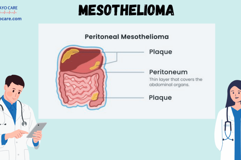 Mesothelioma :Types, Causes, Symptoms, Prevention, Diagnosis, and Treatment