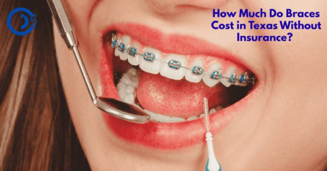 Braces Cost in Texas Without Insurance