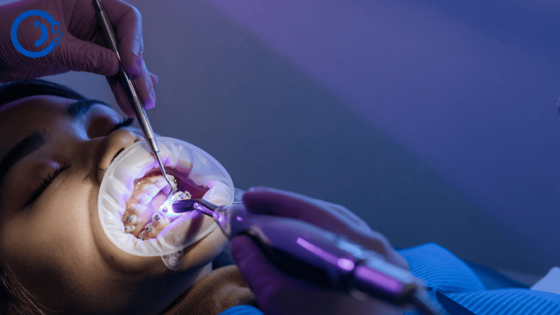 Braces Cost in Texas Without Insurance